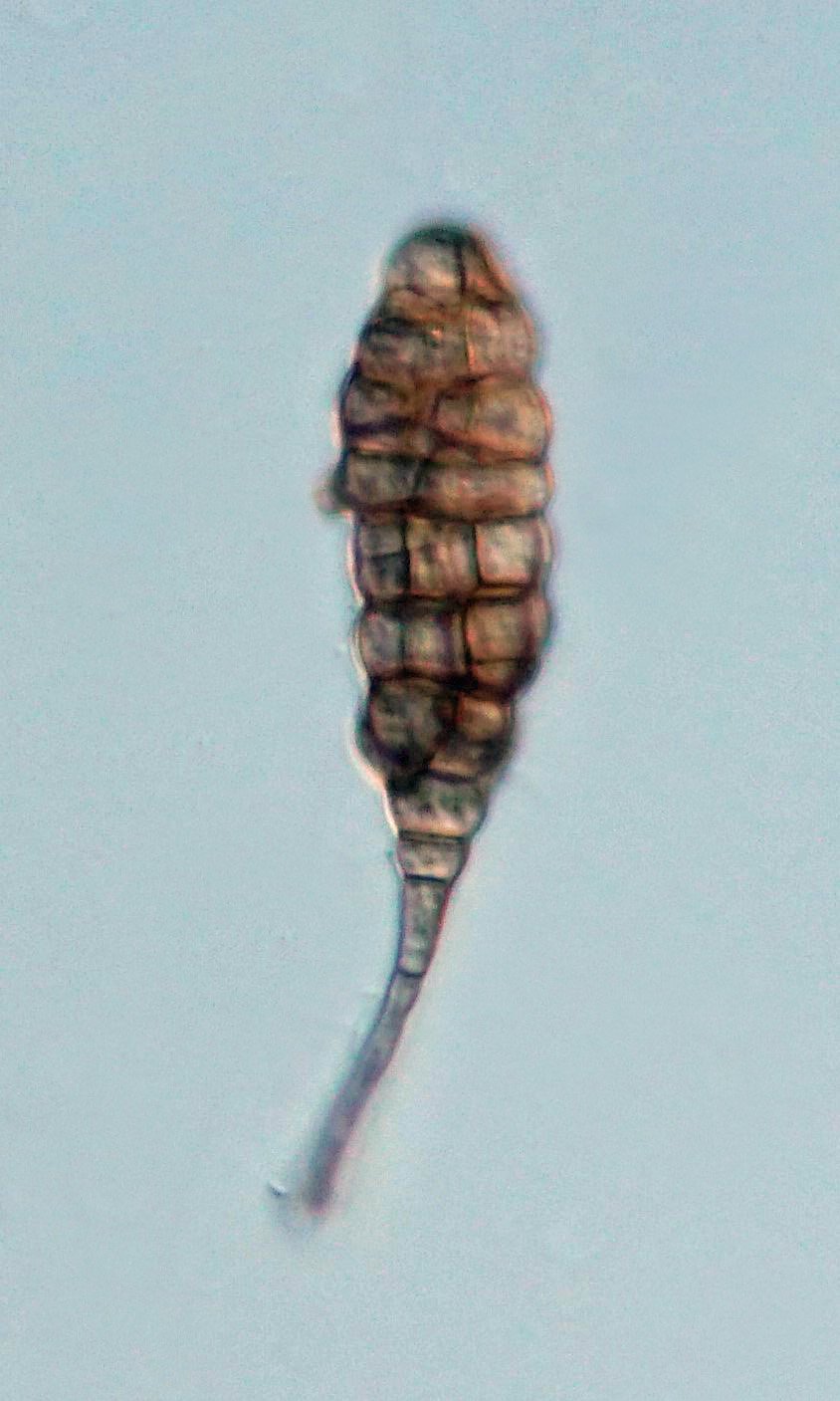 BU 003 Konidie Alternaria.jpg