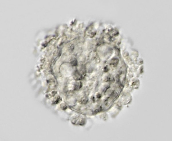 amoebe.p4.jpg