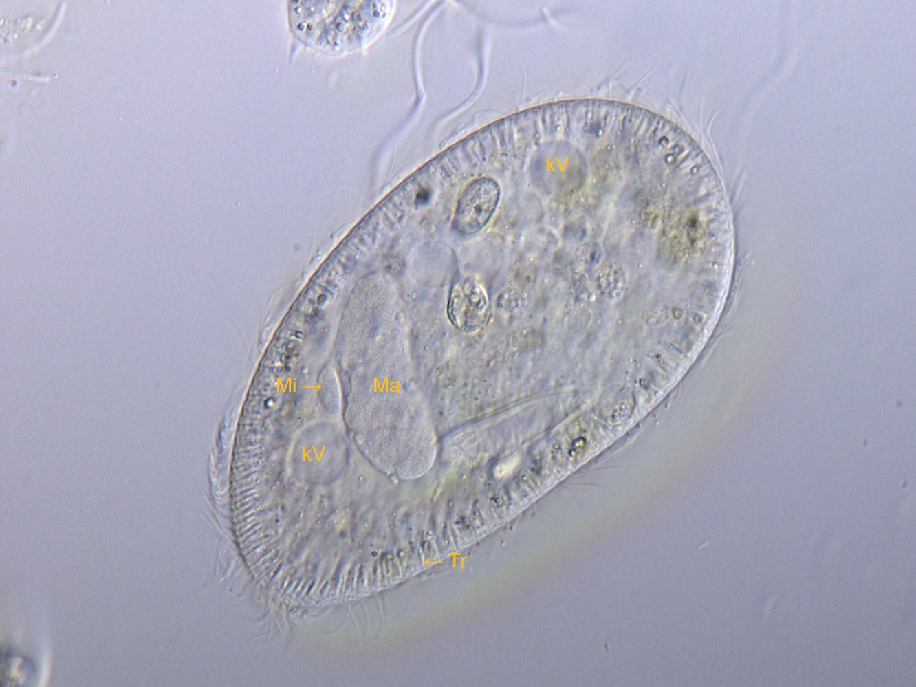 Paramecium_putrinum_HF.jpg