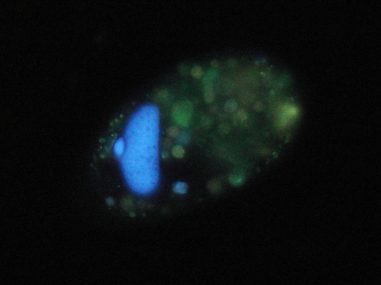 Paramecium_putrinum_FL.jpg